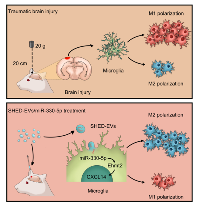 نقش  اگزوزوم های مشتق شده از سلول های بنیادی دندانی حامل miR-330-5p در درمان آسیب تروماتیک مغز 